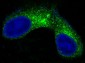 Anti-CEA (CD66e) CEACAM5 Rabbit Monoclonal Antibody