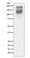 Anti-CEA (CD66e) CEACAM5 Rabbit Monoclonal Antibody