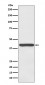Anti-Haptoglobin HP Rabbit Monoclonal Antibody