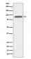 Anti-Lactoferrin LTF Rabbit Monoclonal Antibody