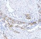 Anti-beta Catenin CTNNB1 Rabbit Monoclonal Antibody