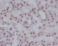 Anti-Cleaved PARP PARP1 Rabbit Monoclonal Antibody