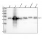 Anti-Cleaved PARP PARP1 Rabbit Monoclonal Antibody