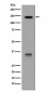 Anti-LDL Receptor Rabbit Monoclonal Antibody