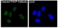 Anti-Cleaved PARP PARP1 Rabbit Monoclonal Antibody