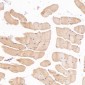 Anti-Cleaved PARP PARP1 Rabbit Monoclonal Antibody