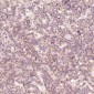 Anti-Cleaved PARP PARP1 Rabbit Monoclonal Antibody