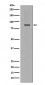 Anti-Cleaved PARP PARP1 Rabbit Monoclonal Antibody