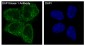 Anti-DAP Kinase 1 DAPK1 Rabbit Monoclonal Antibody
