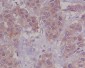 Anti-DAP Kinase 1 DAPK1 Rabbit Monoclonal Antibody