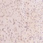 Anti-Calreticulin Rabbit Monoclonal Antibody