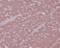 Anti-Synaptophysin SYP Rabbit Monoclonal Antibody