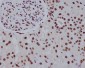 Anti-Histone H2A.Z H2afz Rabbit Monoclonal Antibody