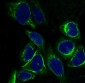 Anti-Cytokeratin 7 KRT7 Rabbit Monoclonal Antibody