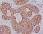 Anti-Cytokeratin 7 KRT7 Rabbit Monoclonal Antibody