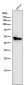 Anti-Cytokeratin 7 KRT7 Rabbit Monoclonal Antibody