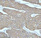 Anti-Cytokeratin 5 KRT5 Rabbit Monoclonal Antibody