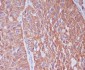 Anti-Cytokeratin 6 Rabbit Monoclonal Antibody