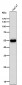 Anti-Cytokeratin 6 Rabbit Monoclonal Antibody