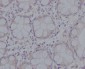 Anti-pro Caspase 3 CASP3 Rabbit Monoclonal Antibody