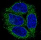 Anti-Cytokeratin 7 KRT7 Rabbit Monoclonal Antibody