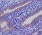 Anti-Cytokeratin 7 KRT7 Rabbit Monoclonal Antibody
