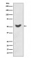 Anti-Cytokeratin 7 KRT7 Rabbit Monoclonal Antibody