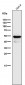 Anti-Cytokeratin 7 KRT7 Rabbit Monoclonal Antibody