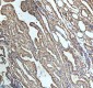 Anti-beta I Tubulin TUBB1 Rabbit Monoclonal Antibody