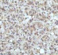 Anti-beta I Tubulin TUBB1 Rabbit Monoclonal Antibody