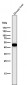 Anti-Cytokeratin 18 KRT18 Rabbit Monoclonal Antibody