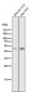 Anti-Cytokeratin 18 KRT18 Rabbit Monoclonal Antibody