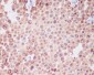 Anti-PMEL17 / GP100 Rabbit Monoclonal Antibody