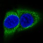 Anti-Cytokeratin 10 KRT10 Rabbit Monoclonal Antibody