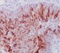 Anti-Cytokeratin 10 KRT10 Rabbit Monoclonal Antibody