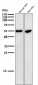 Anti-Cytokeratin 10 KRT10 Rabbit Monoclonal Antibody