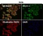 Anti-Cytokeratin 18 Krt18 Rabbit Monoclonal Antibody