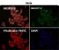 Anti-Cytokeratin 18 Krt18 Rabbit Monoclonal Antibody
