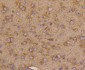Anti-VEGF Receptor 1 FLT1 Rabbit Monoclonal Antibody