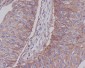 Anti-Integrin beta 1 ITGB1 Rabbit Monoclonal Antibody