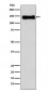 Anti-Integrin beta 1 ITGB1 Rabbit Monoclonal Antibody