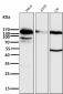 Anti-Integrin beta 1 ITGB1 Rabbit Monoclonal Antibody