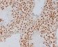 Anti-Alpha Synuclein SNCA Rabbit Monoclonal Antibody