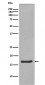 Anti-Alpha Synuclein SNCA Rabbit Monoclonal Antibody
