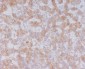Anti-Serum Amyloid A SAA1 Rabbit Monoclonal Antibody