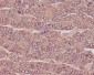 Anti-beta III Tubulin TUBB3 Rabbit Monoclonal Antibody