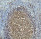 Anti-beta III Tubulin TUBB3 Rabbit Monoclonal Antibody