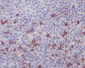 Anti-Integrin alpha E ITGAE Rabbit Monoclonal Antibody