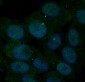 Anti-Insulin Receptor INSR Rabbit Monoclonal Antibody