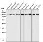 Anti-Insulin Receptor INSR Rabbit Monoclonal Antibody